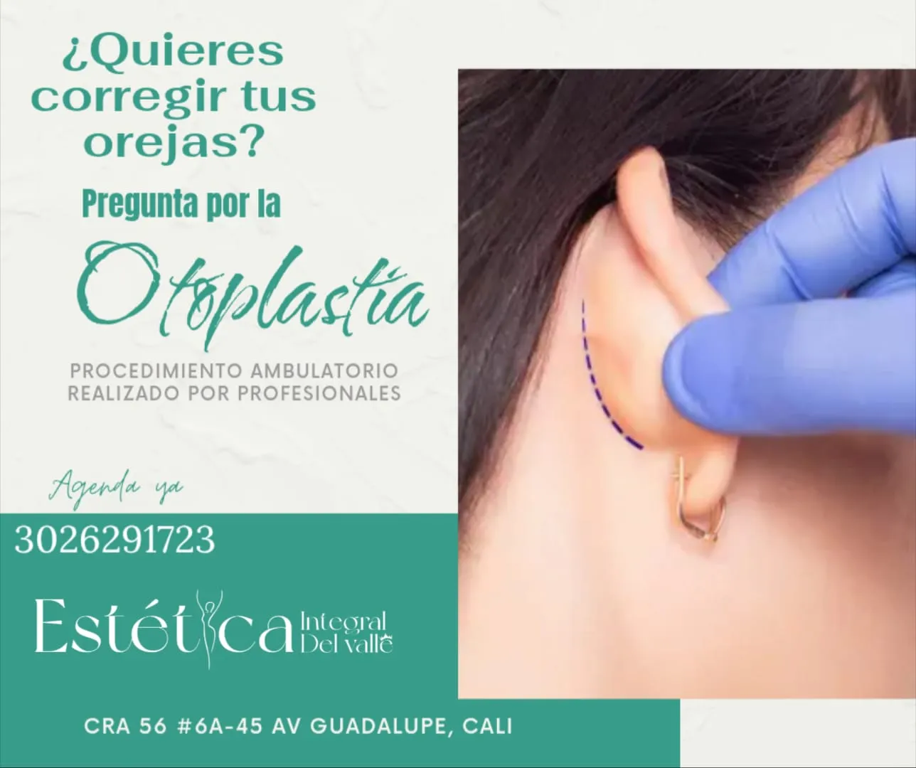 OTOPLASTIA - 1