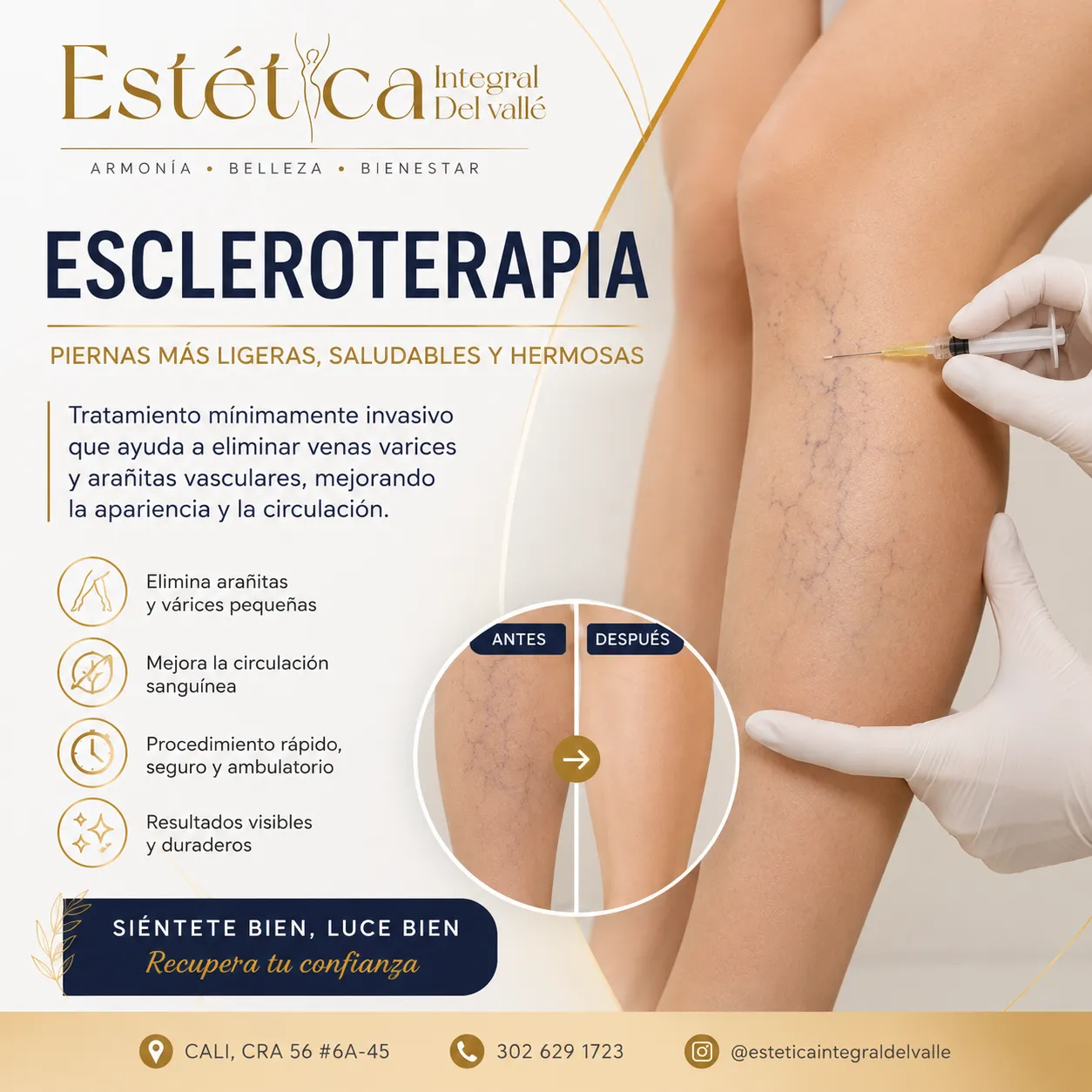 ESCLEROTERAPIA VENITAS