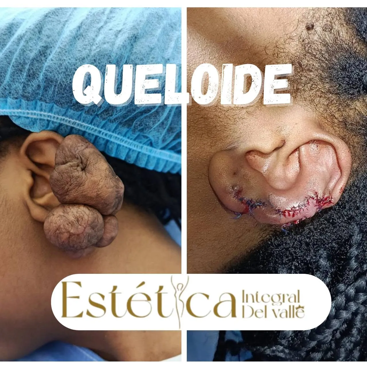 QUELIODE - 1