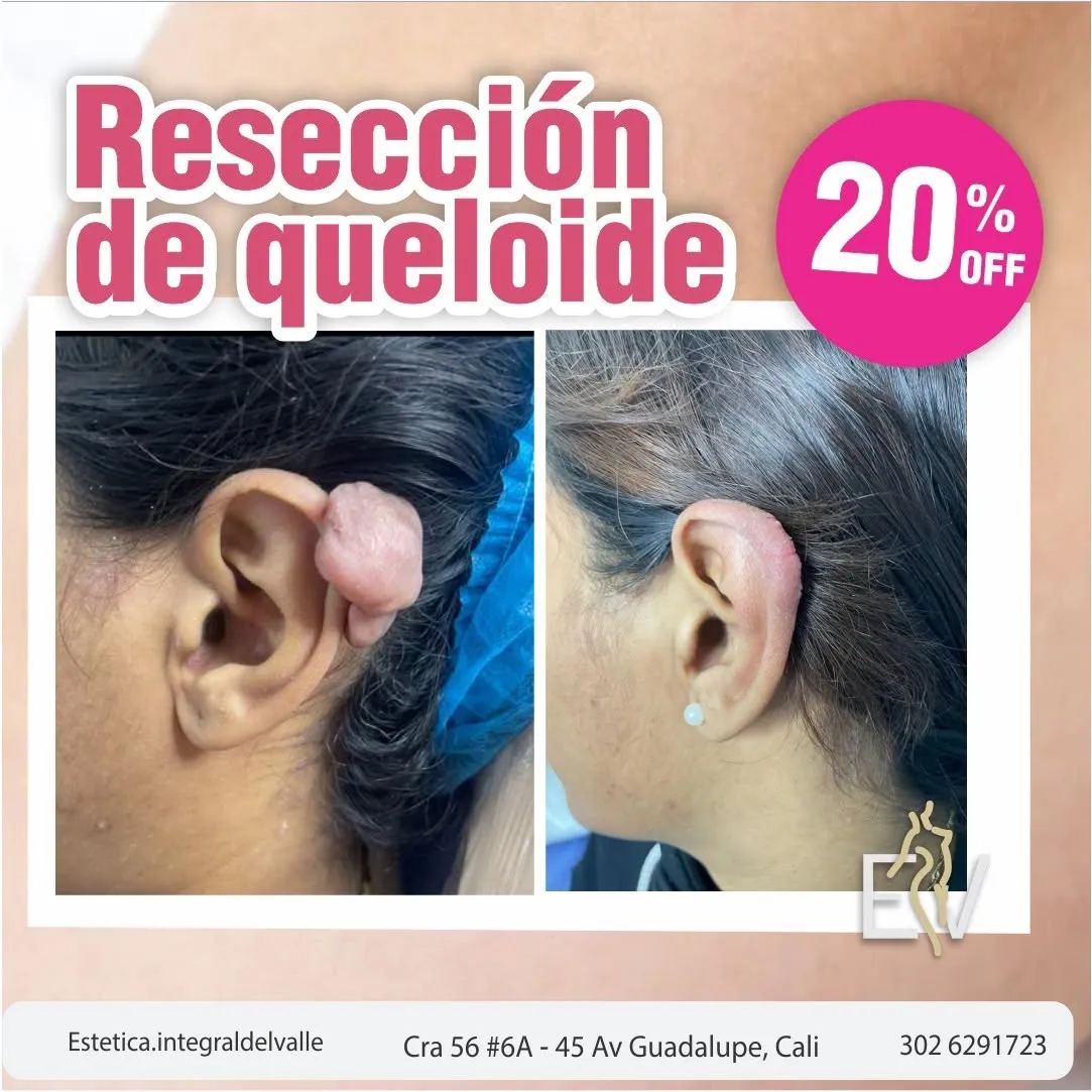 QUELIODE - 2