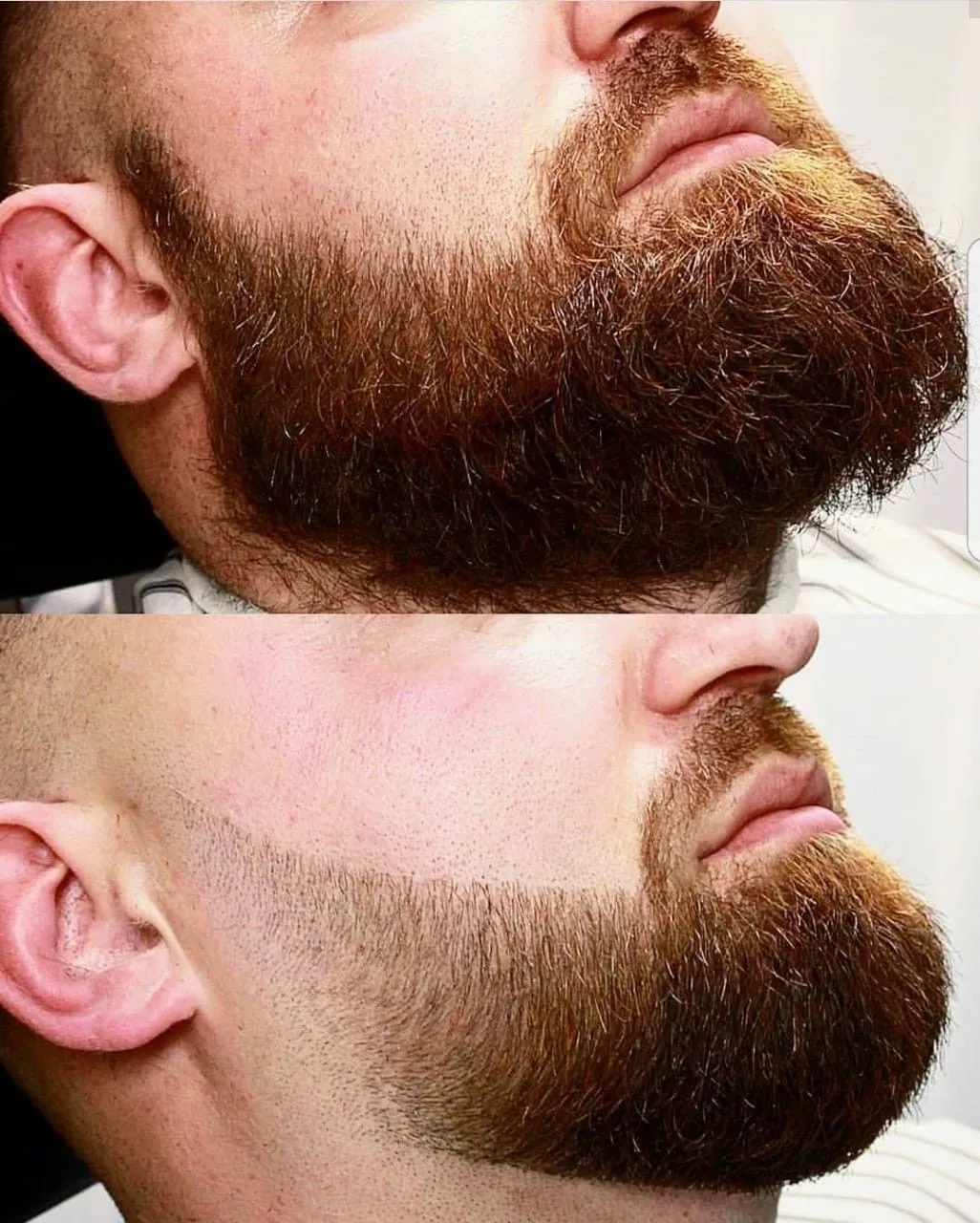 DISEÑO DE BARBA