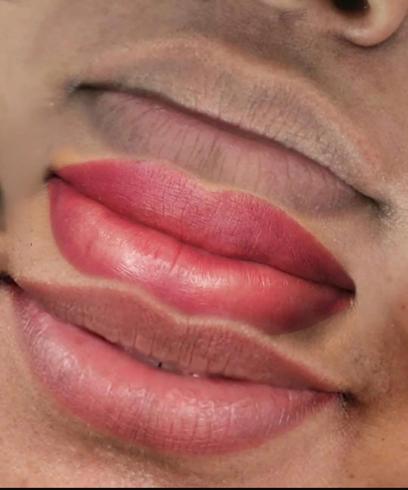 RETOQUE DE NEUTRALIZACIÓN LABIAL