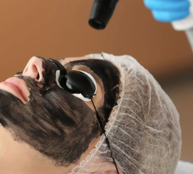 Hollywood Peel + Limpieza Classic en Facial