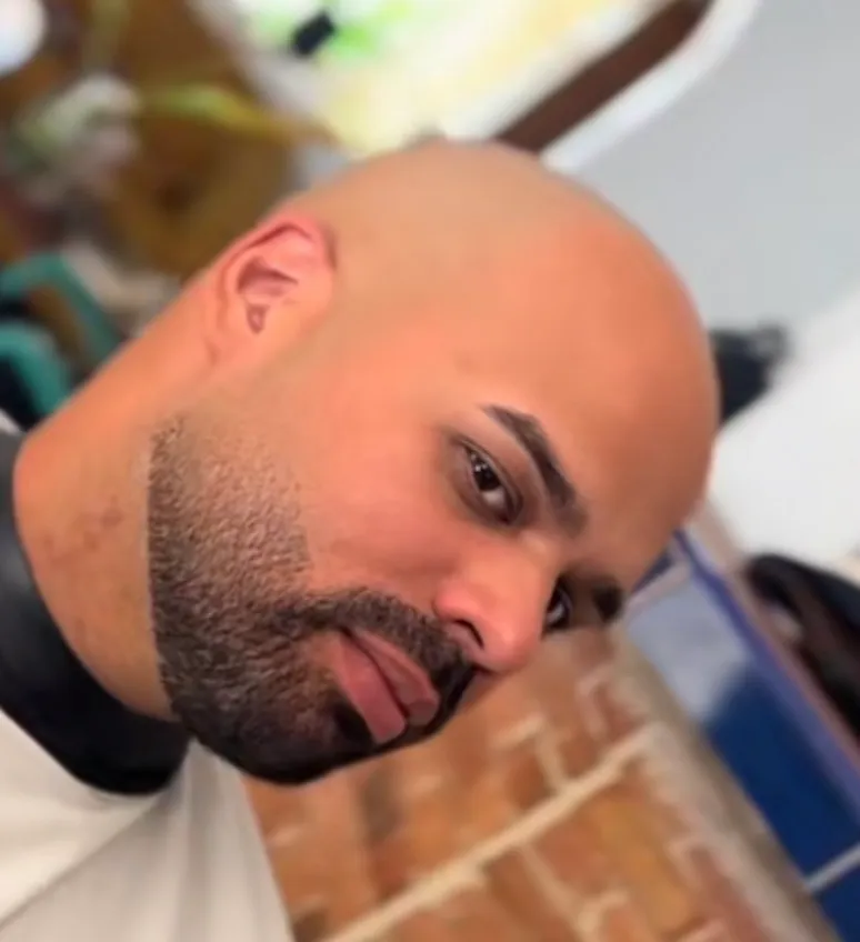 Calvitos con Barba 👨‍🦲🧔