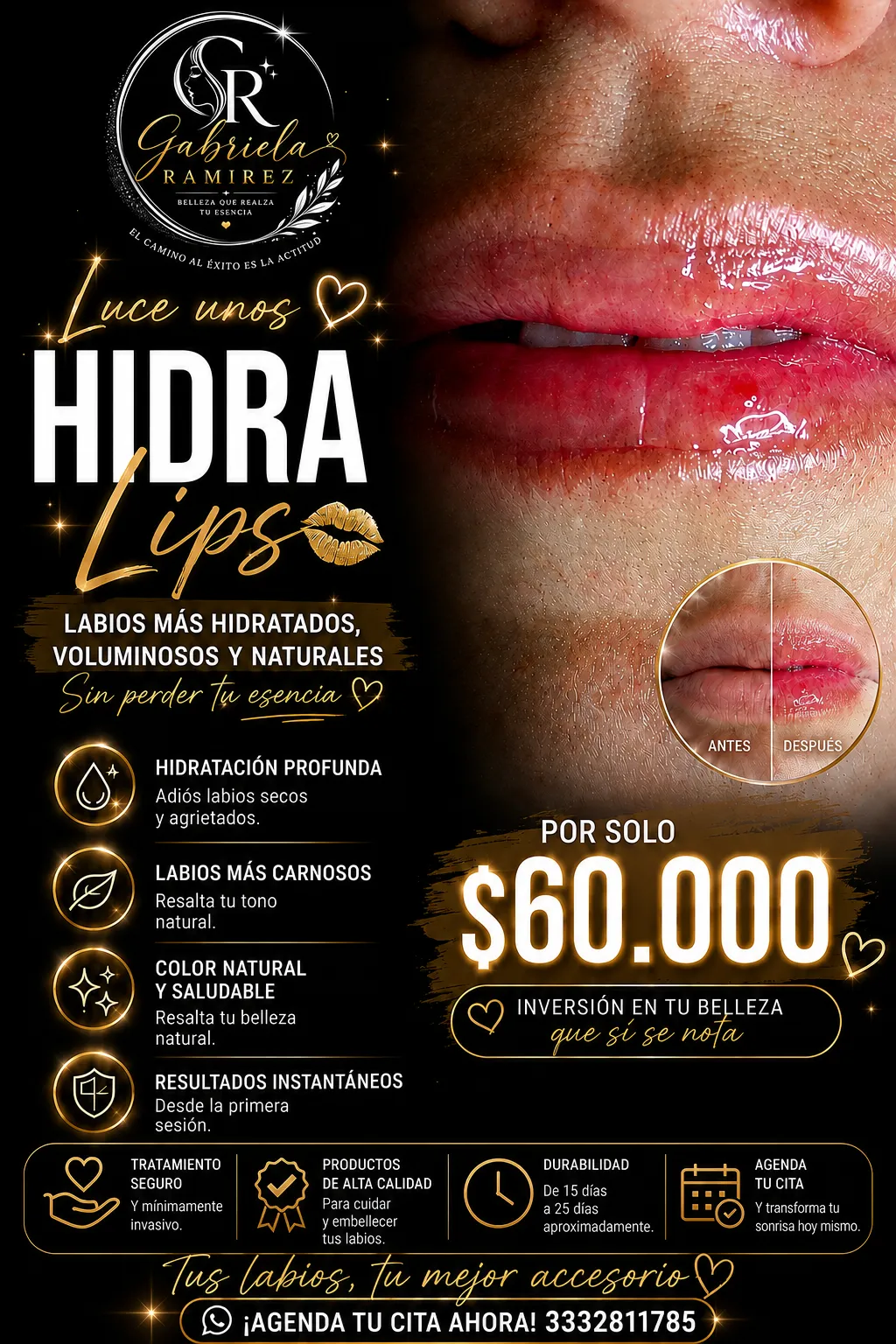 hidralips