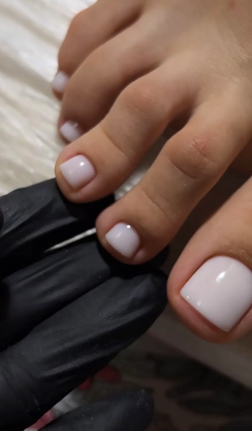 Estética de pies