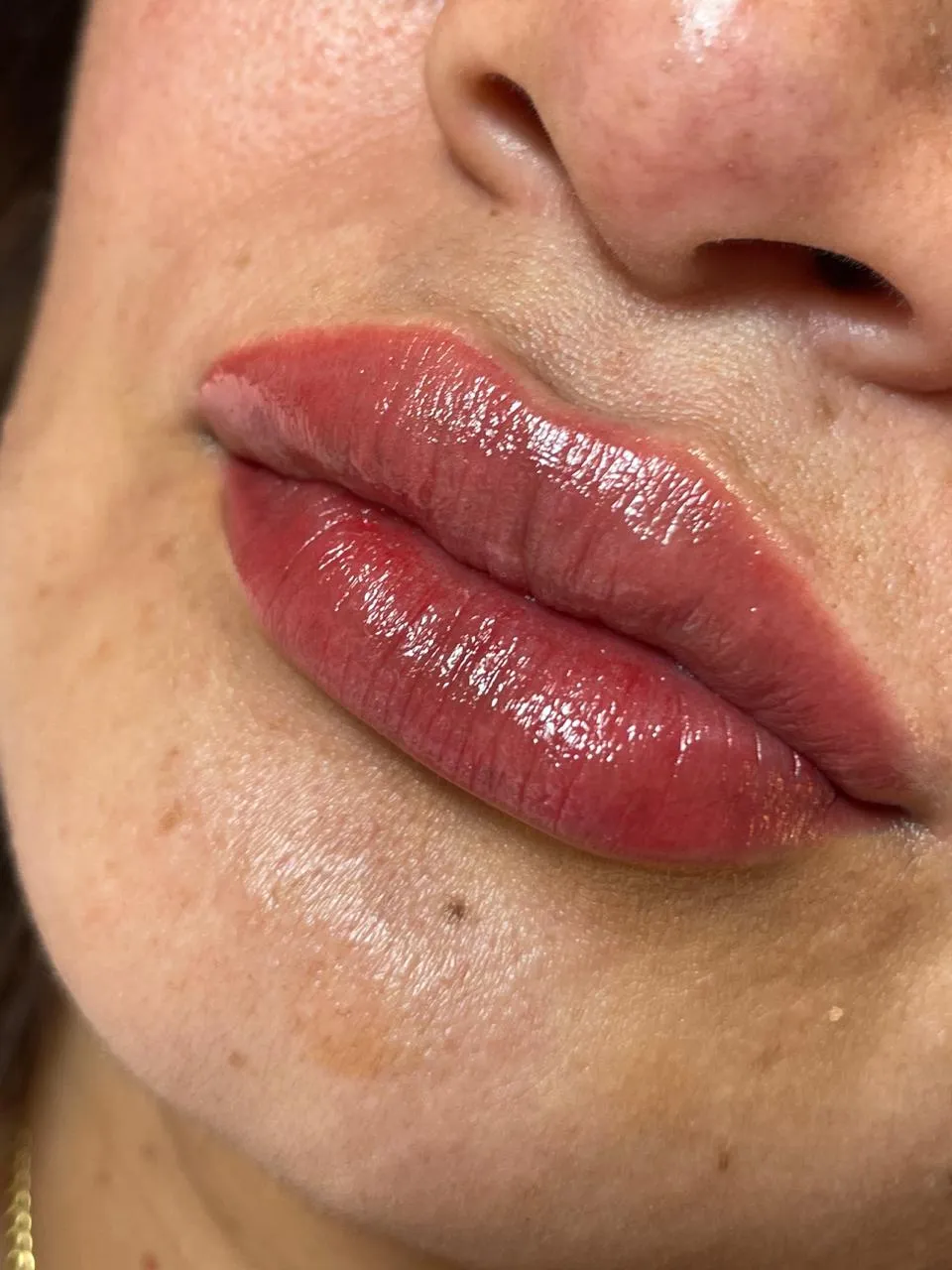 MICROLIPS
