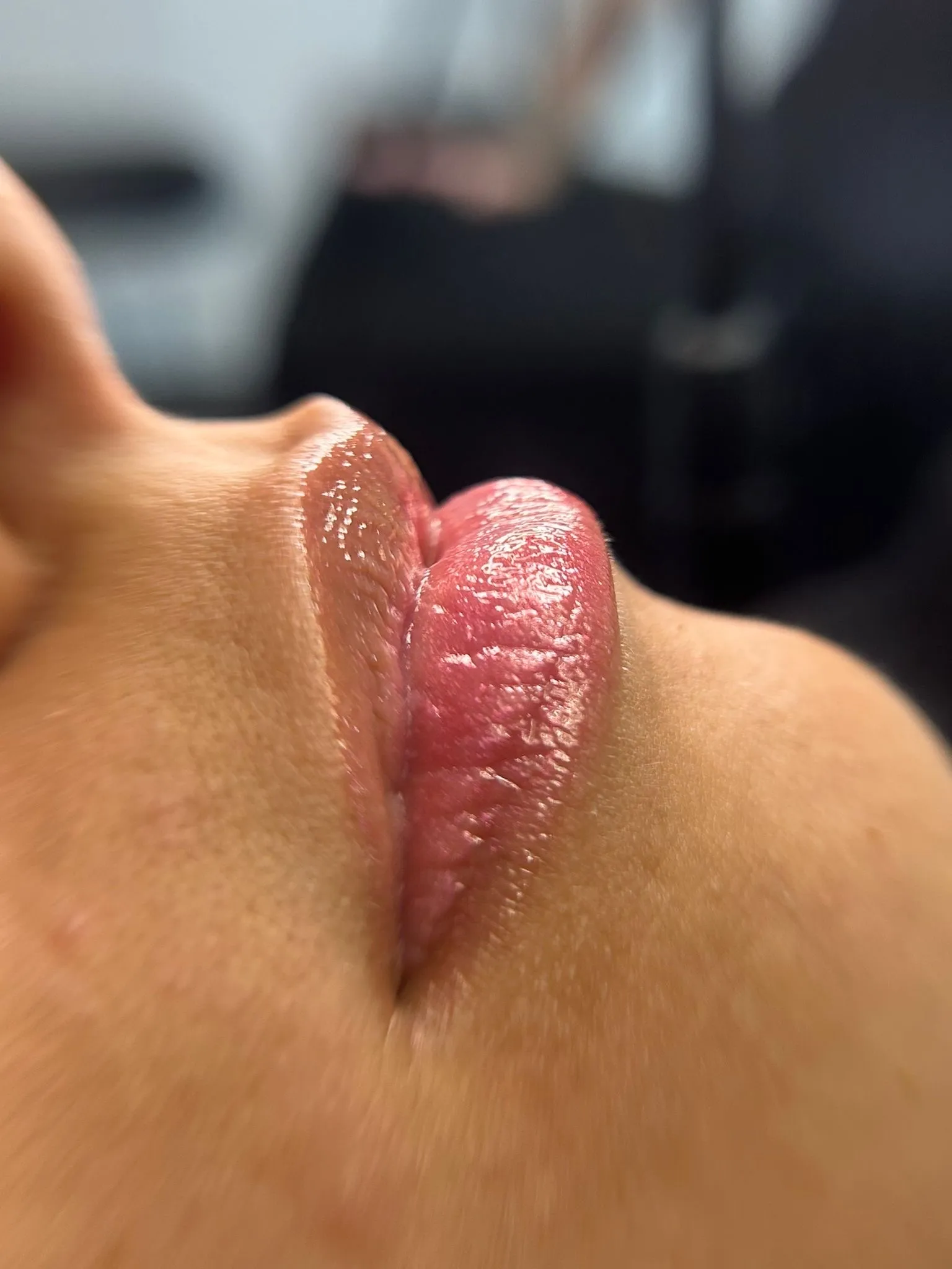 Hydragloss lips