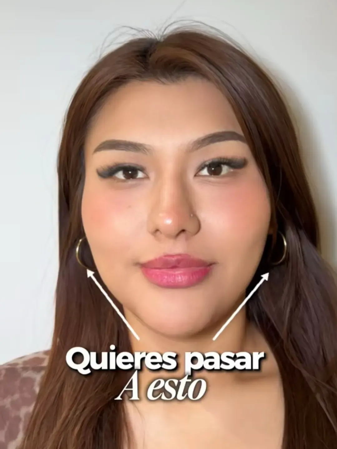 Botox en Maseteros