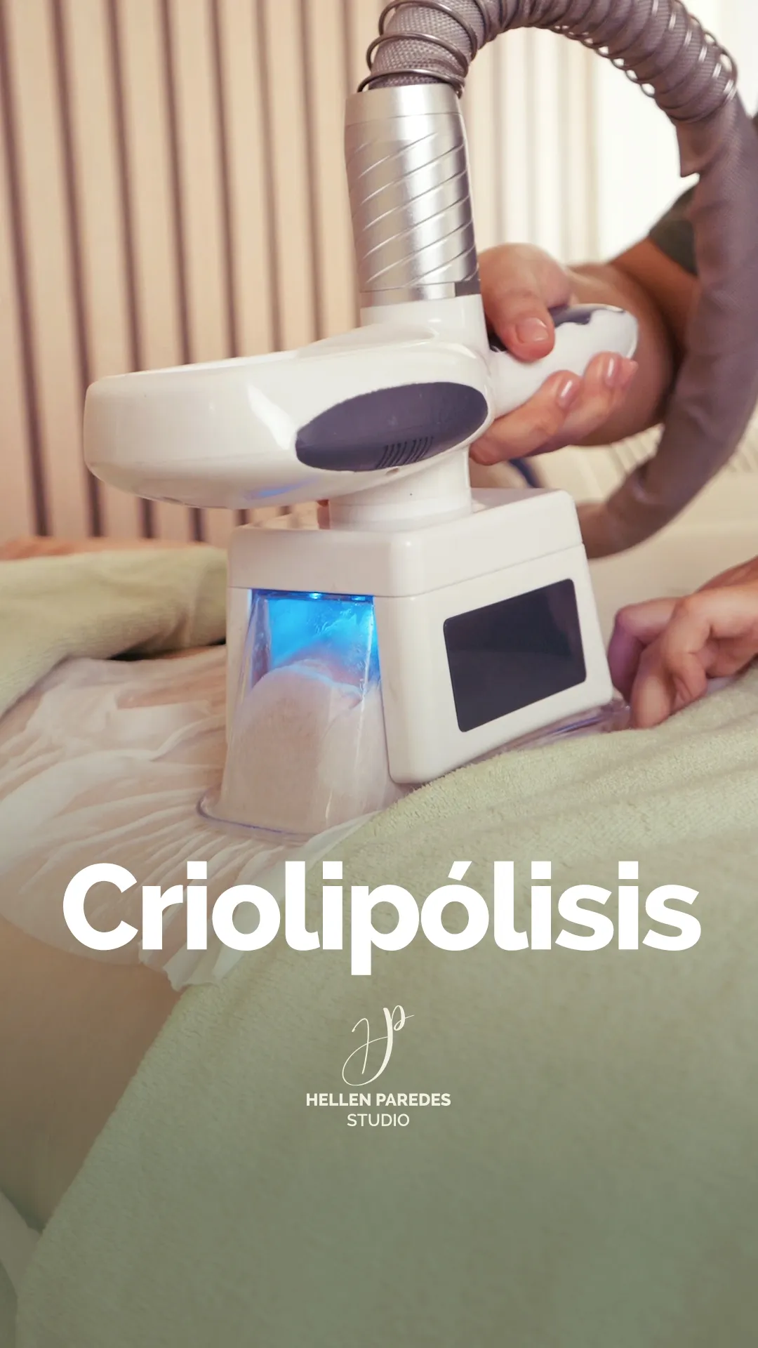 CRIOLIPOLISIS