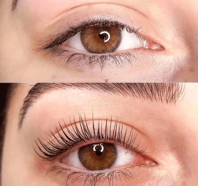 Lifting sin tinte - Imagen 2