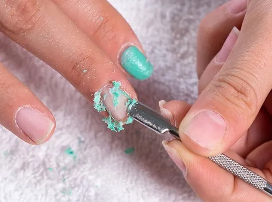 Retiro de Gel (propio) - Imagen 1