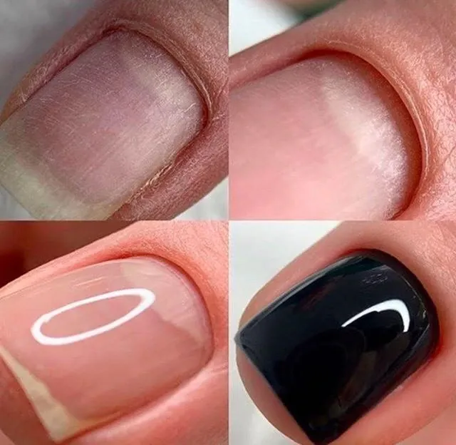 Esmaltado semipermanente 