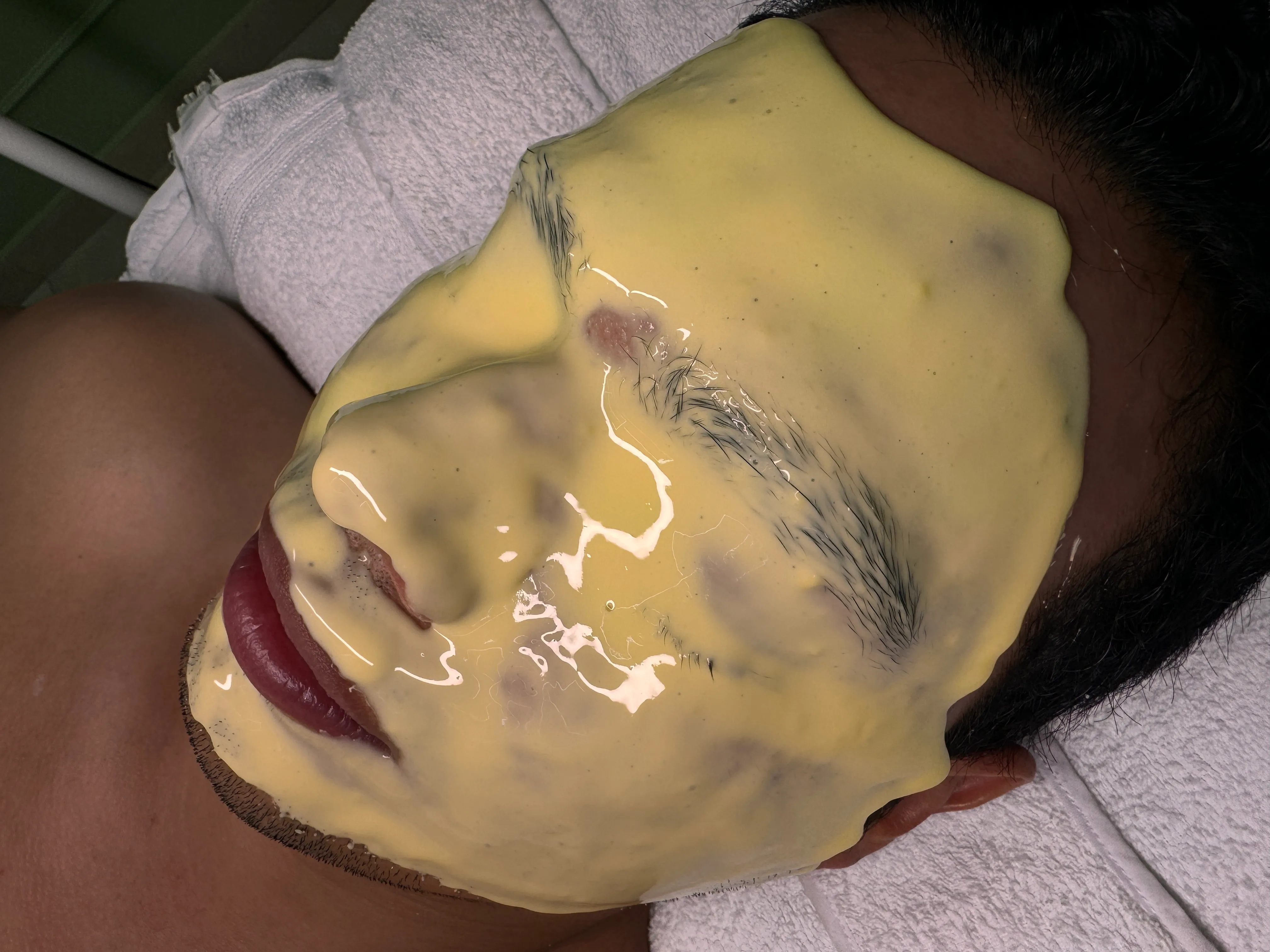 RENOVACIÓN FACIAL - Imagen 1