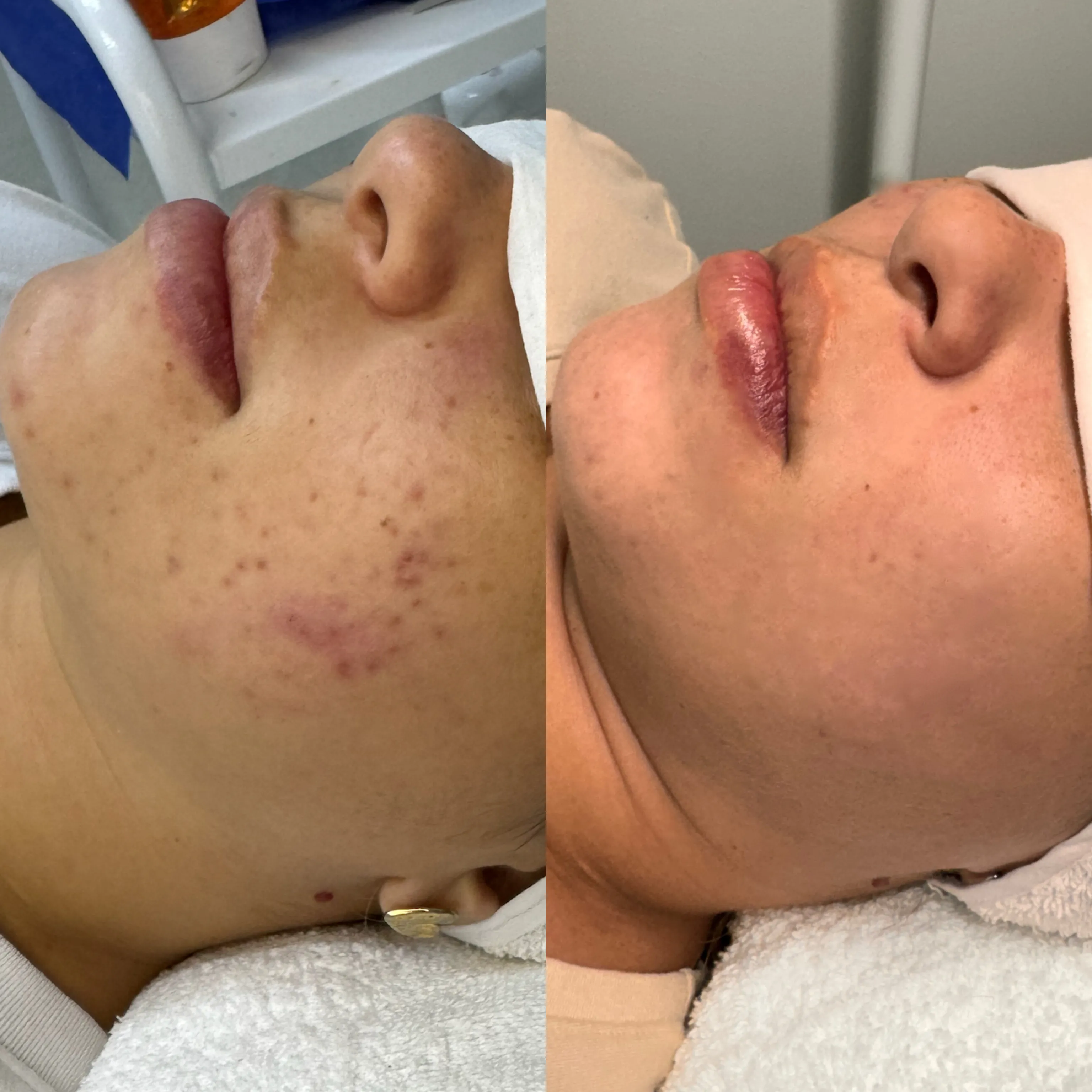 SKINS AVANZADO - Imagen 1