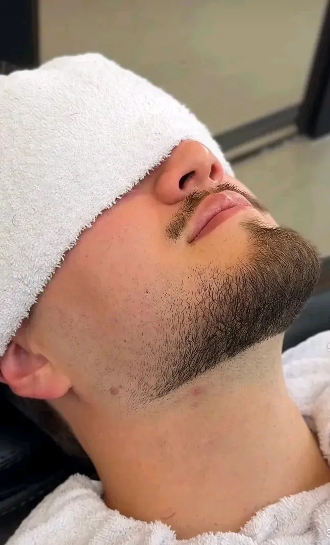 Corte de barba - Imagen 1