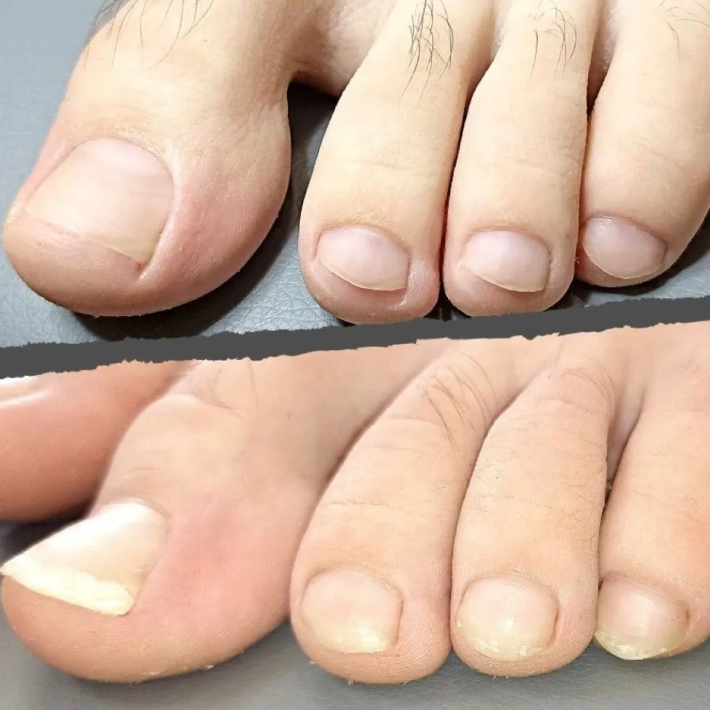 Pedicure Caballero