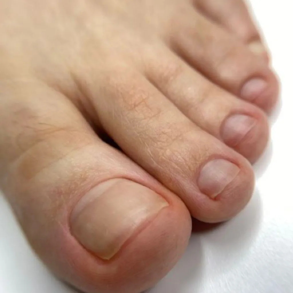 Corte de uñas