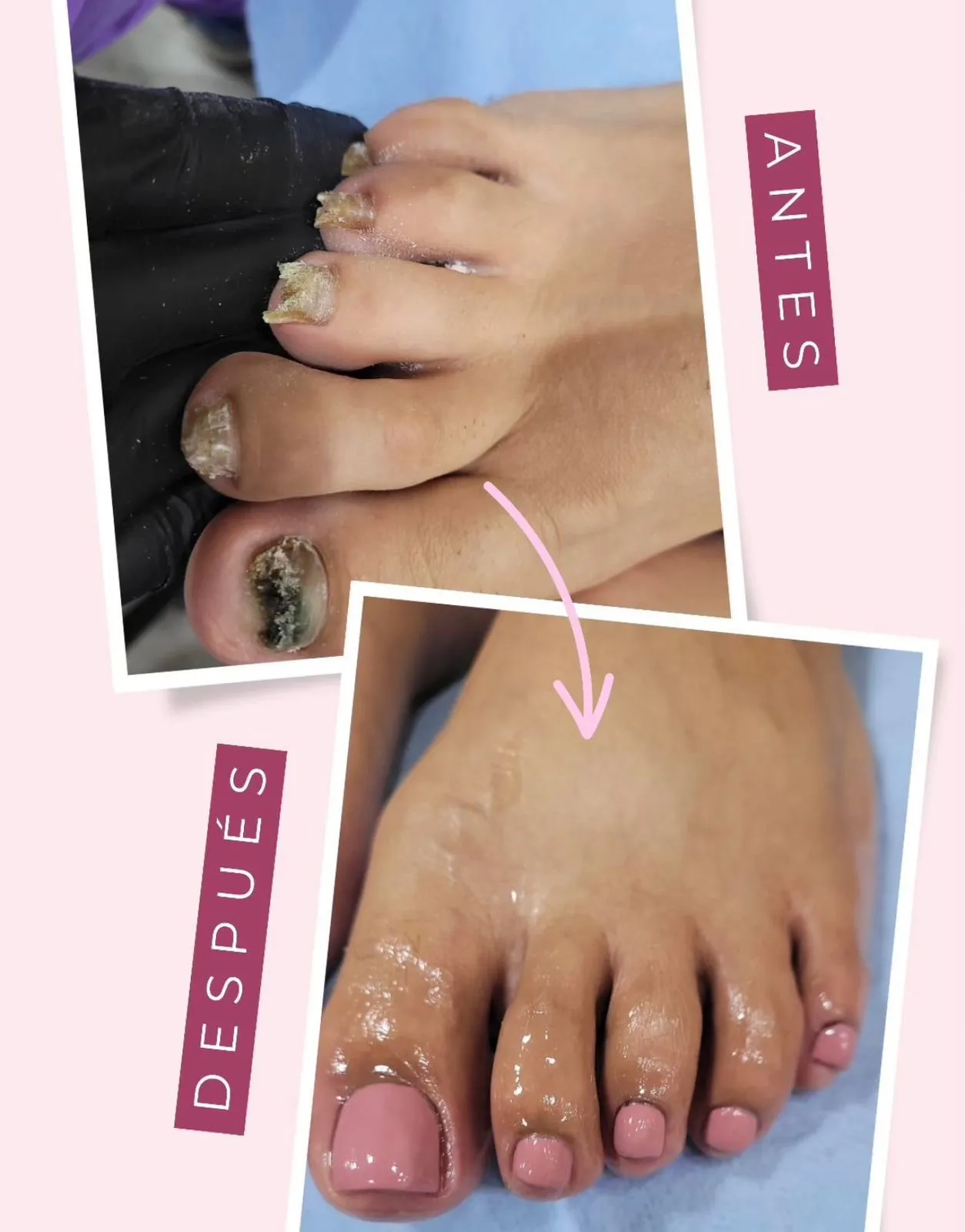 Oni Completo - Imagen 1