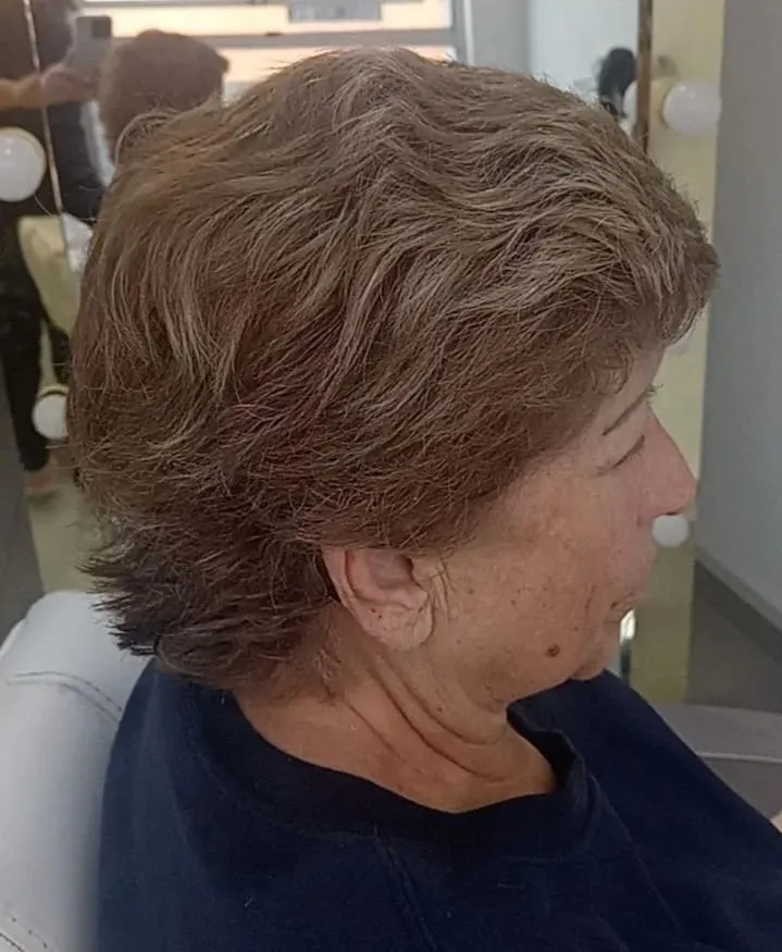Cubrimiento de canas de raíz - 1