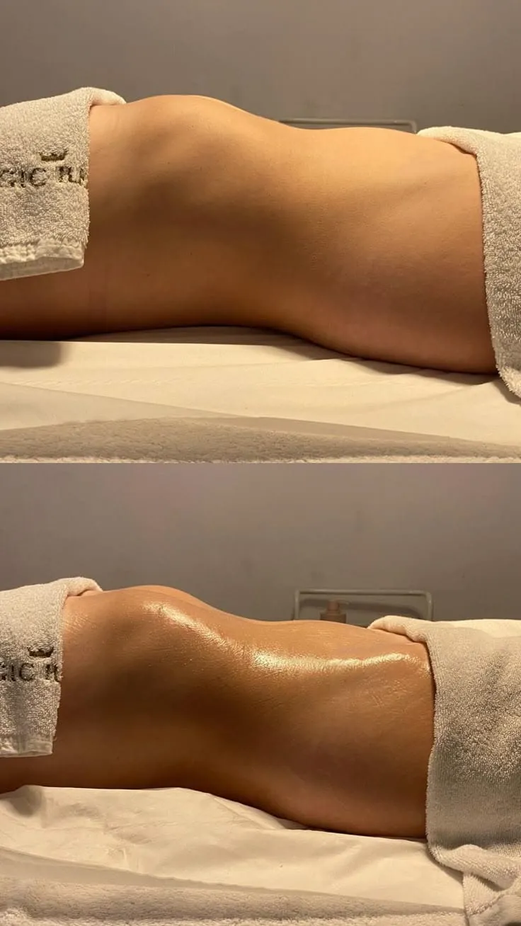 Lipomasajes - 3