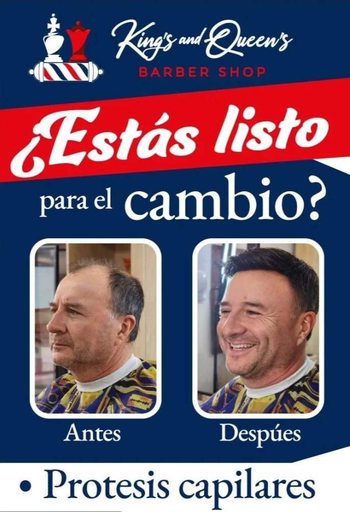 PROTESIS CAPILAR 👨‍🦲