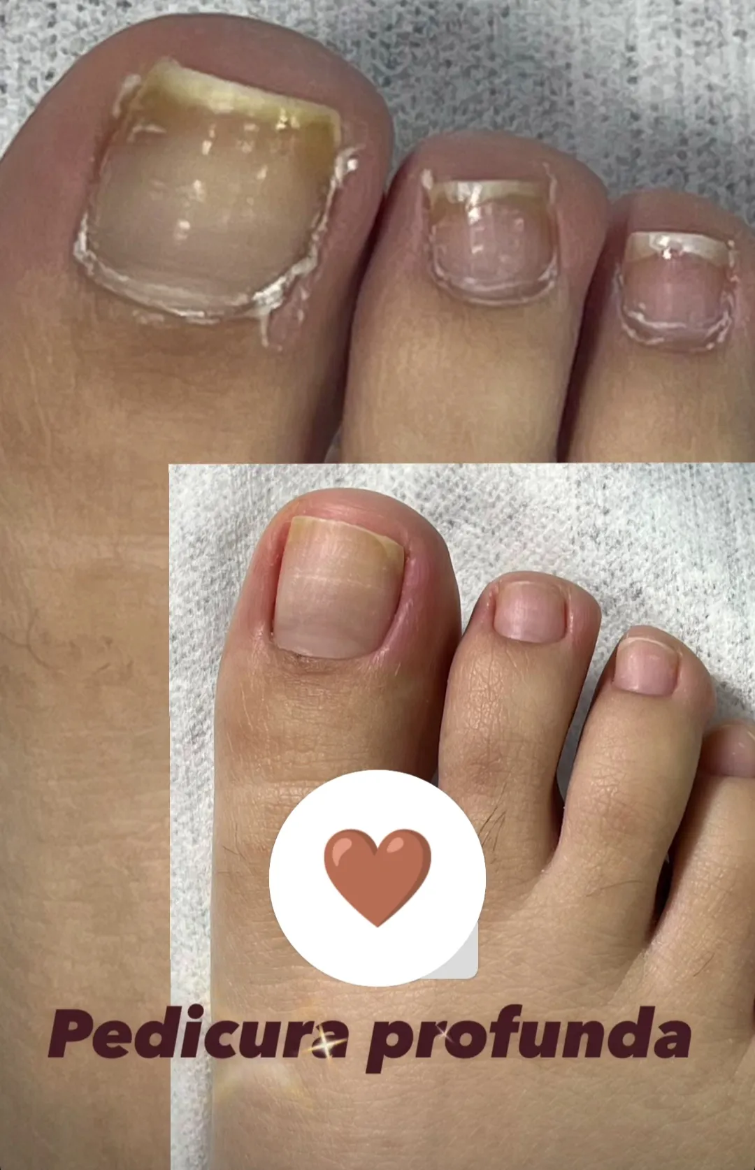 pedicura profunda - Imagen 1