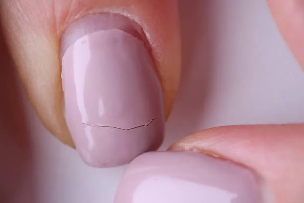 Reparación de 1 a 2 Uñas (Cualquier Sistema)