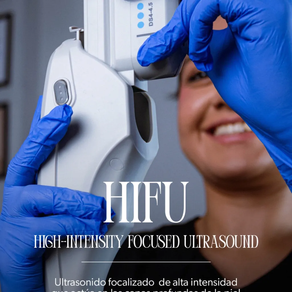 HIFU Papada y Contorno mandibular