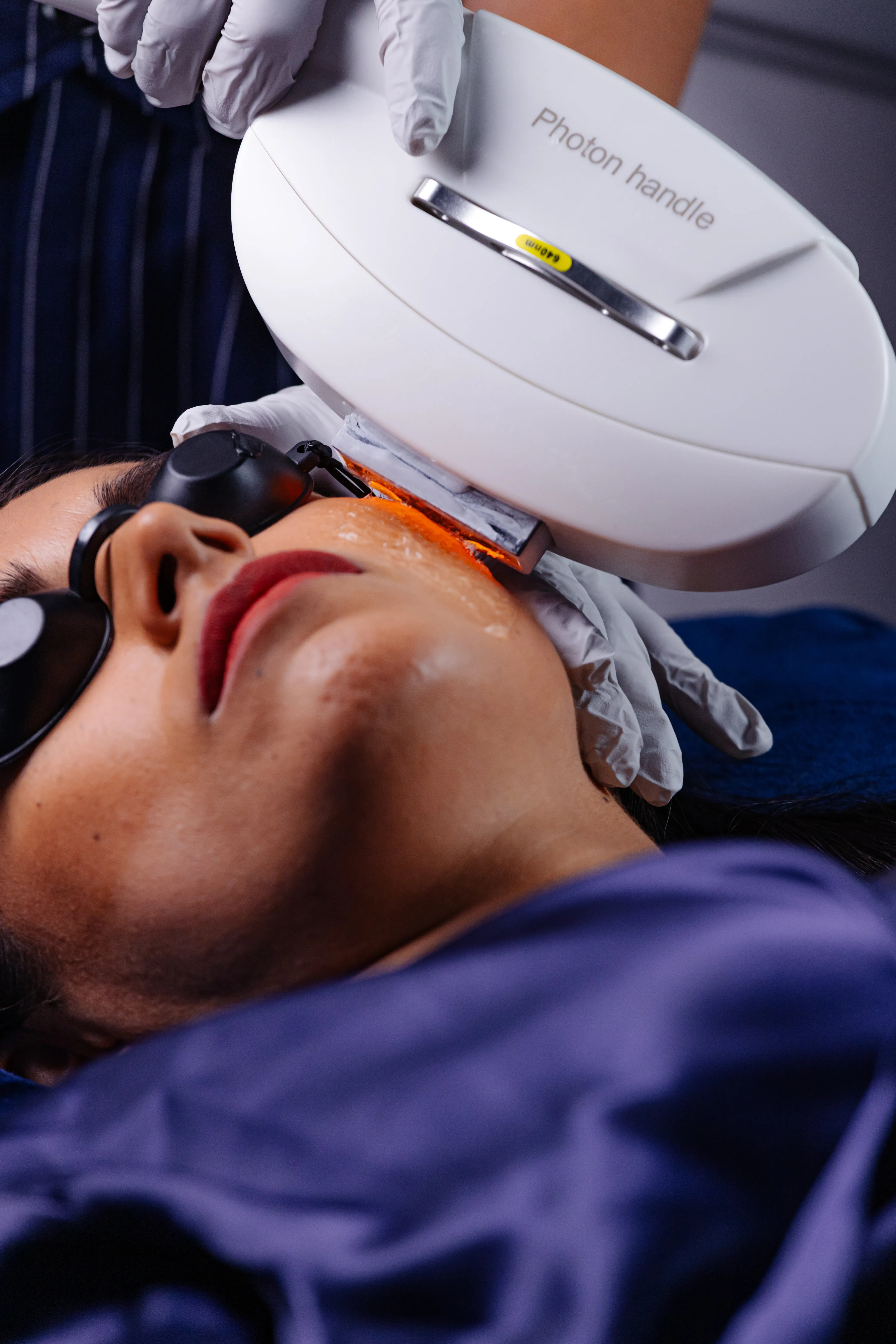 Depilación Rostro + Axilas + Piernas  - 3