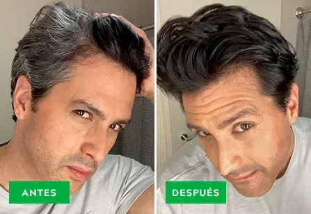 RECUBRIMIENTOS DE CANAS - SHAMPOO