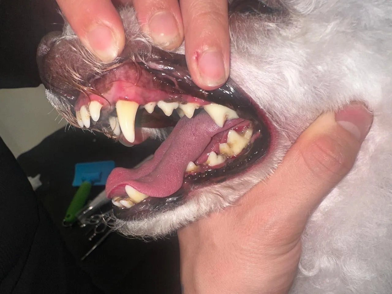 Limpieza dental profunda