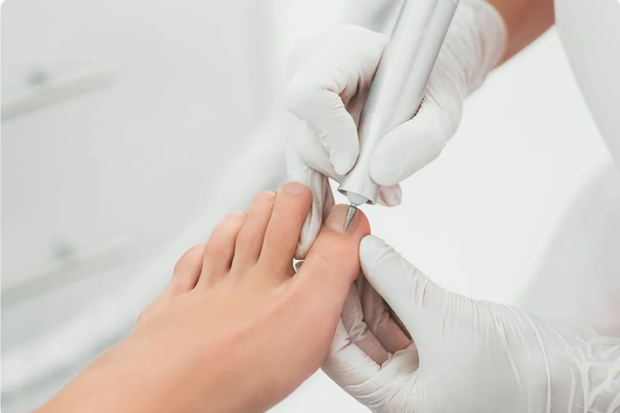 Profilaxis Podologica - Imagen 1