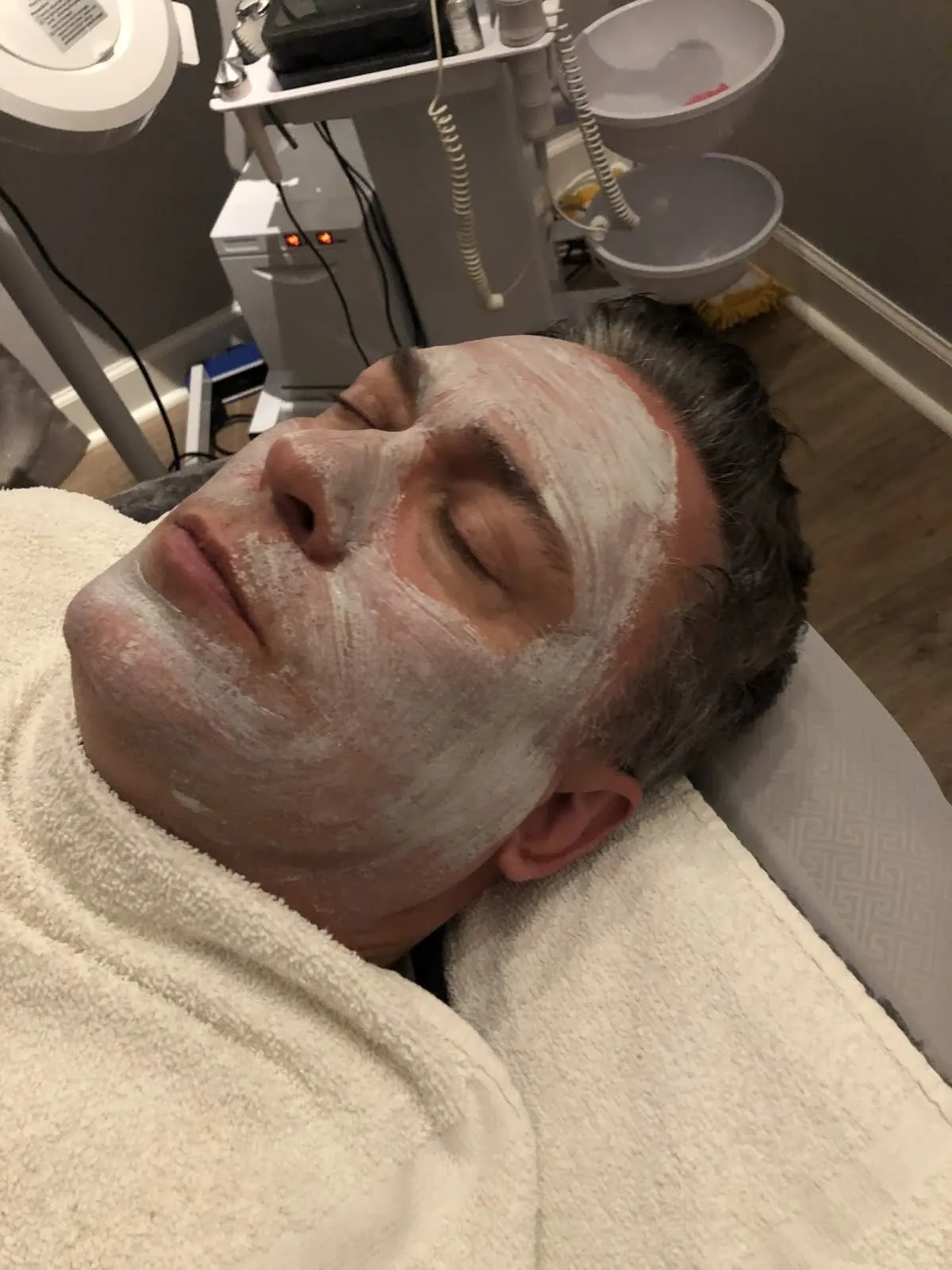 exfoliacion facial