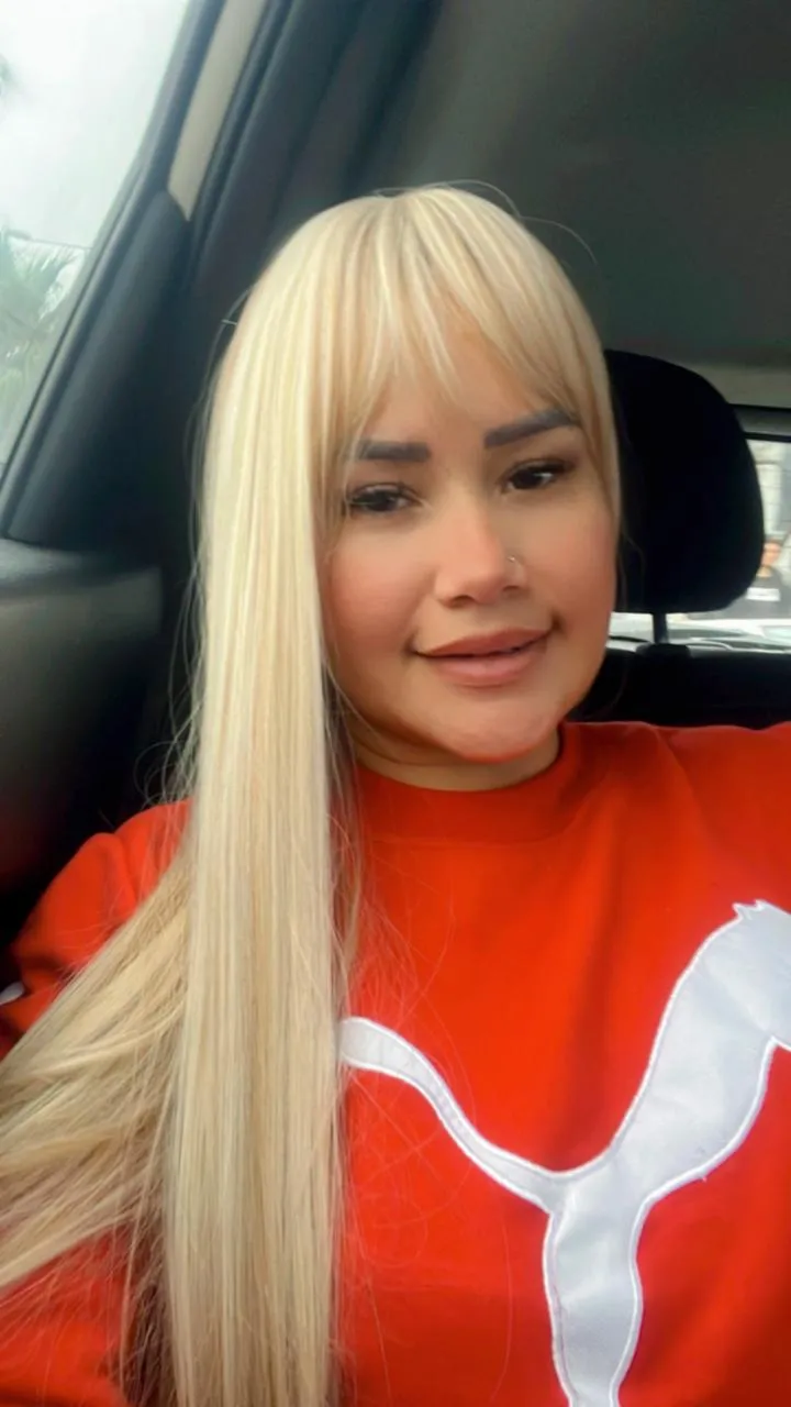 INSTALACIÓN DE PELUCA - Imagen 2