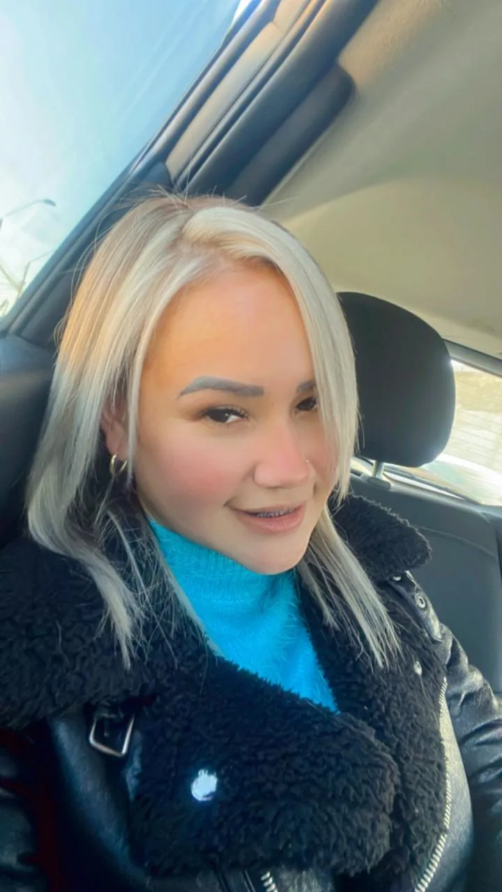 INSTALACIÓN DE PELUCA - Imagen 1