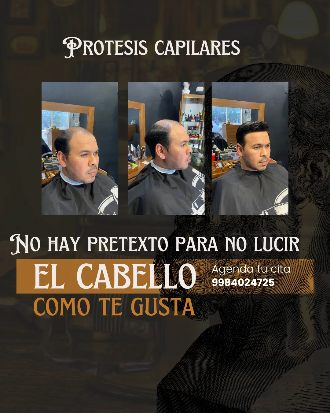 colocación de prótesis capilares  - Imagen 1