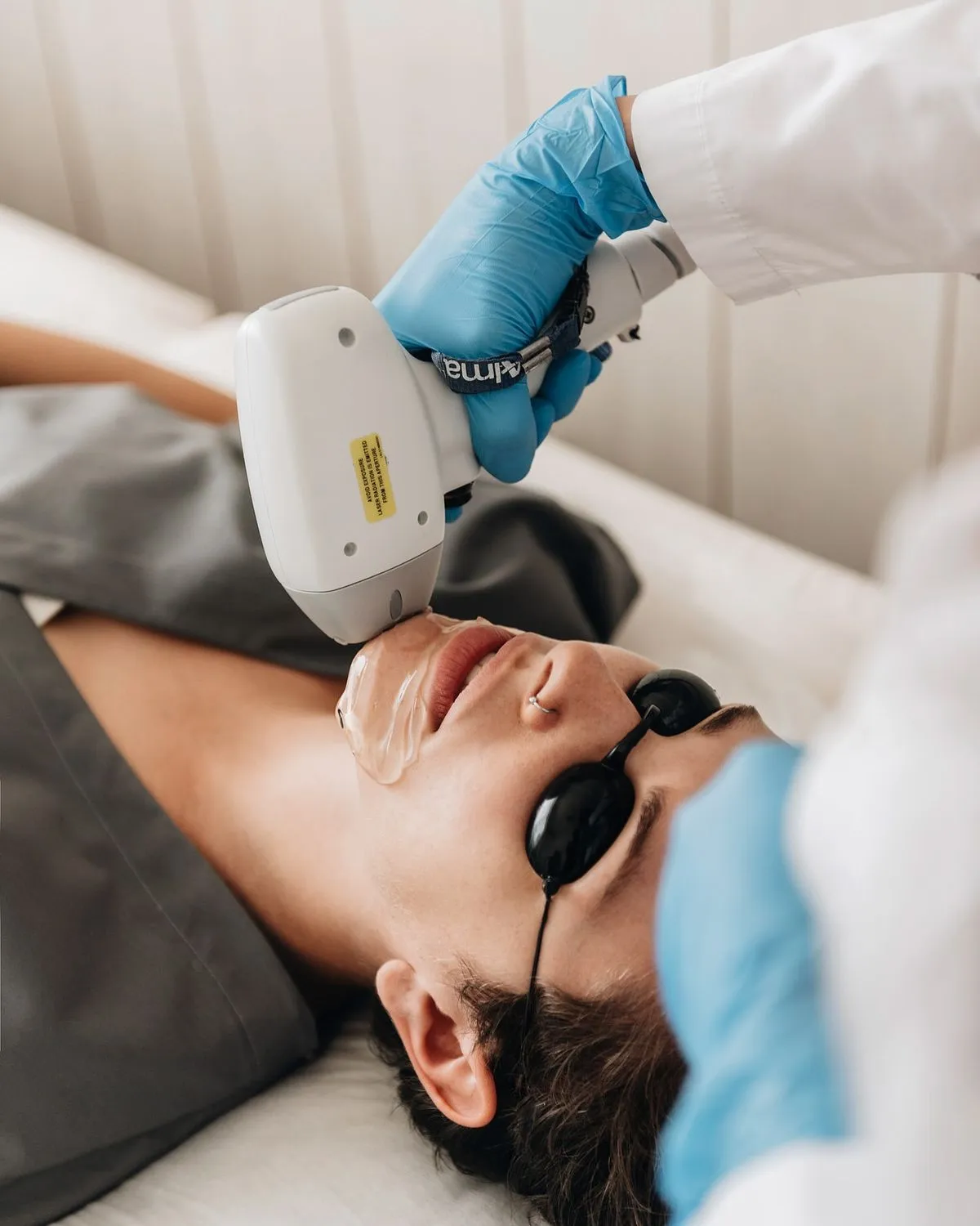 DEPILACION FACIAL LASER