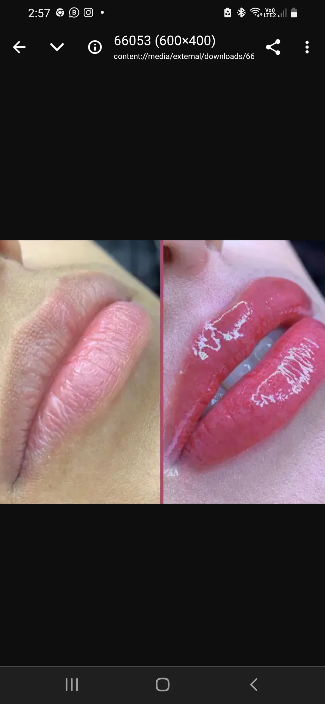 Hidra Gloss Lips