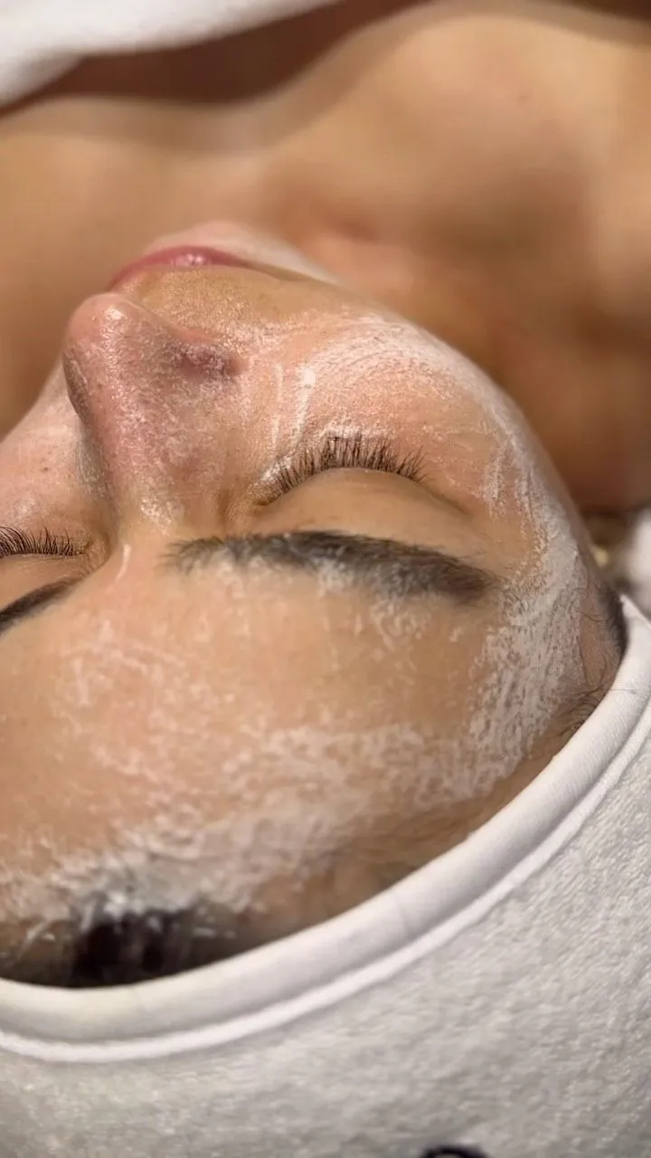 LIMPIEZA FACIAL  (CLASICA)