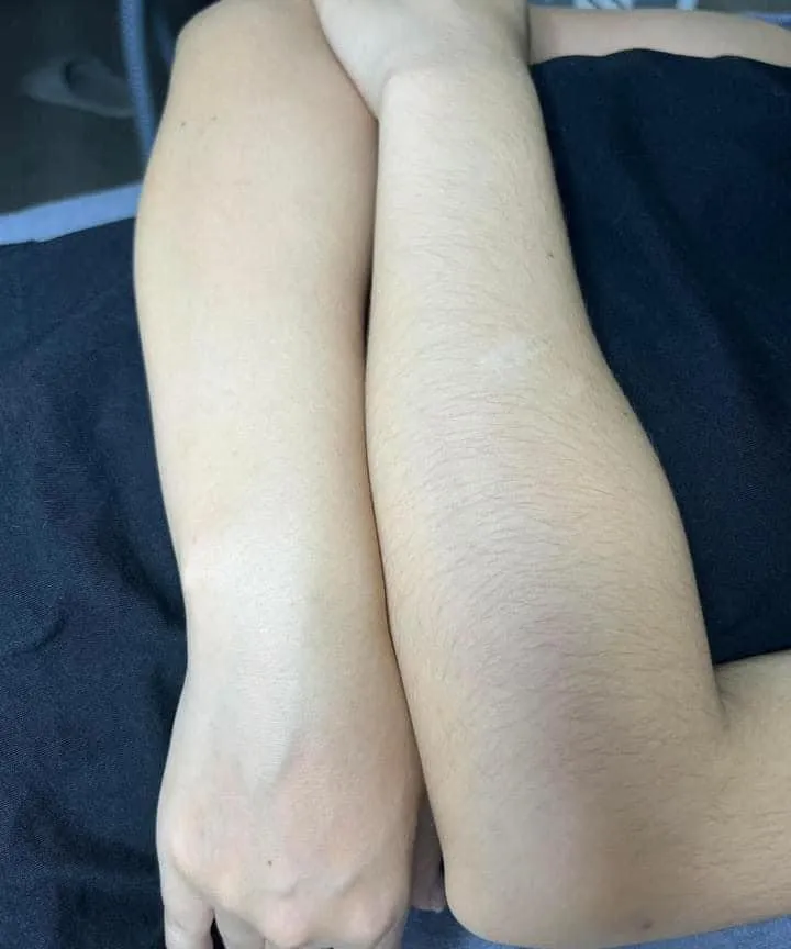 DEPILACION DE BRAZOS  - Imagen 1