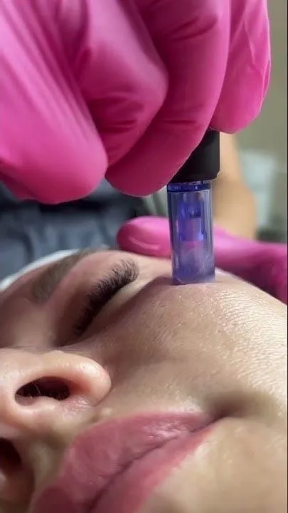 Dermapen