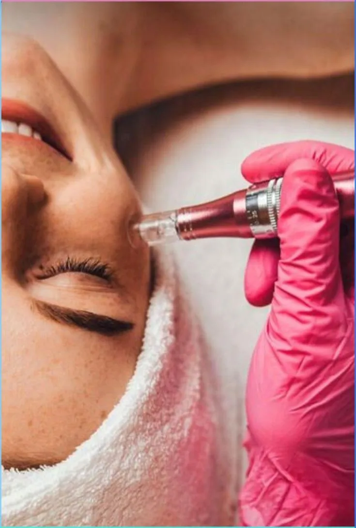 Skin Rehab (Dermapen)