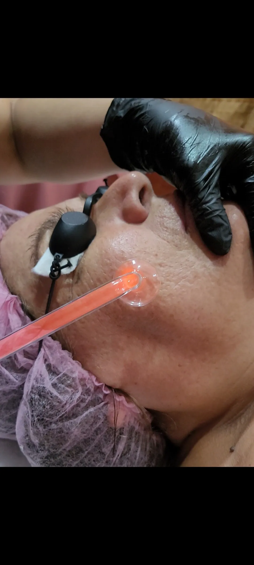 Limpieza facial
