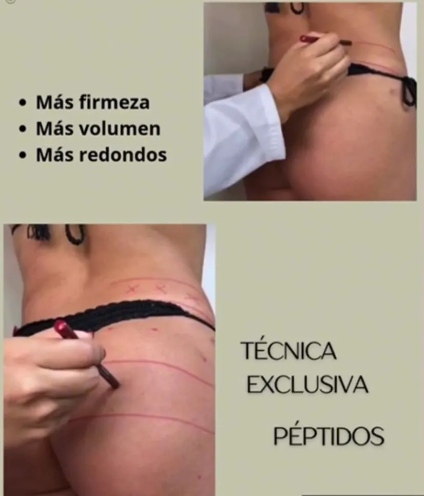 TONIFICACIÓN - Imagen 1