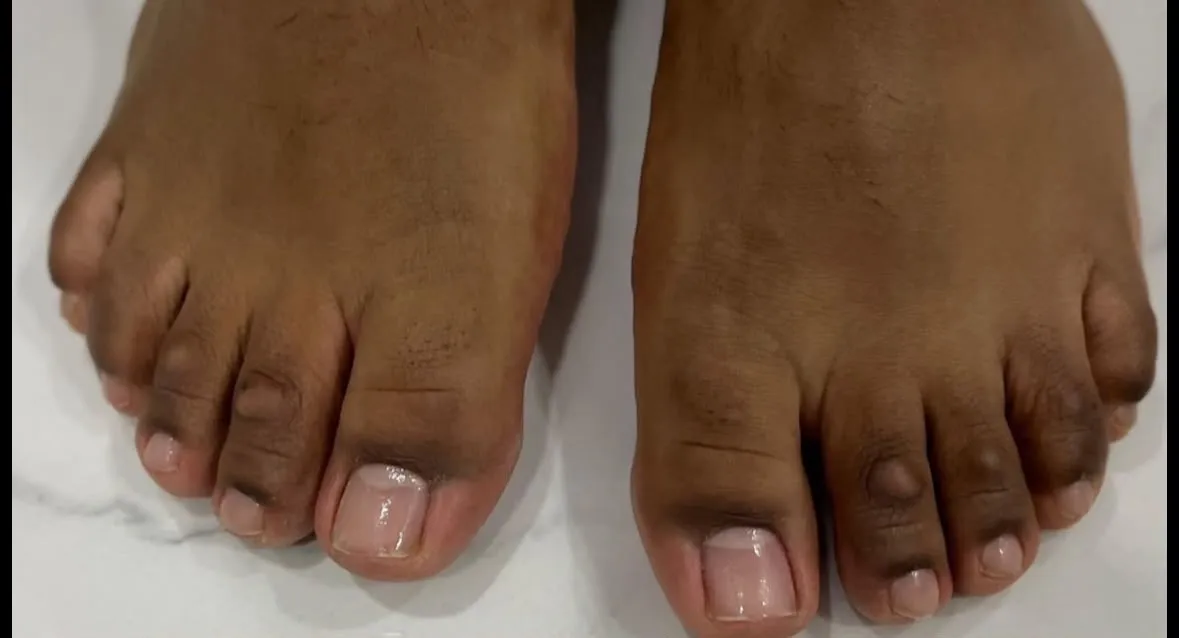 Pedicura semipermanente (Hombre)🦋