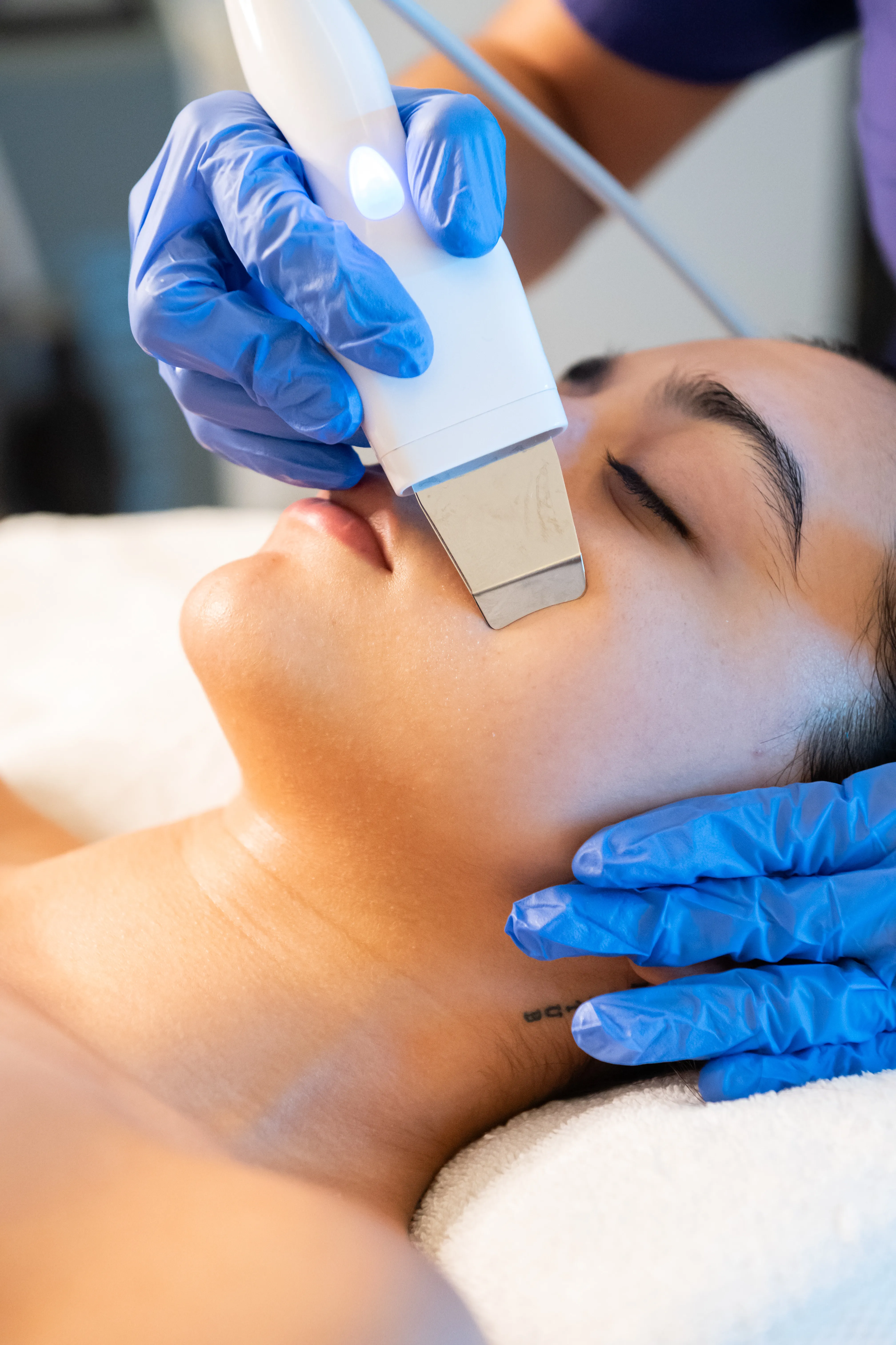 limpieza facial profunda