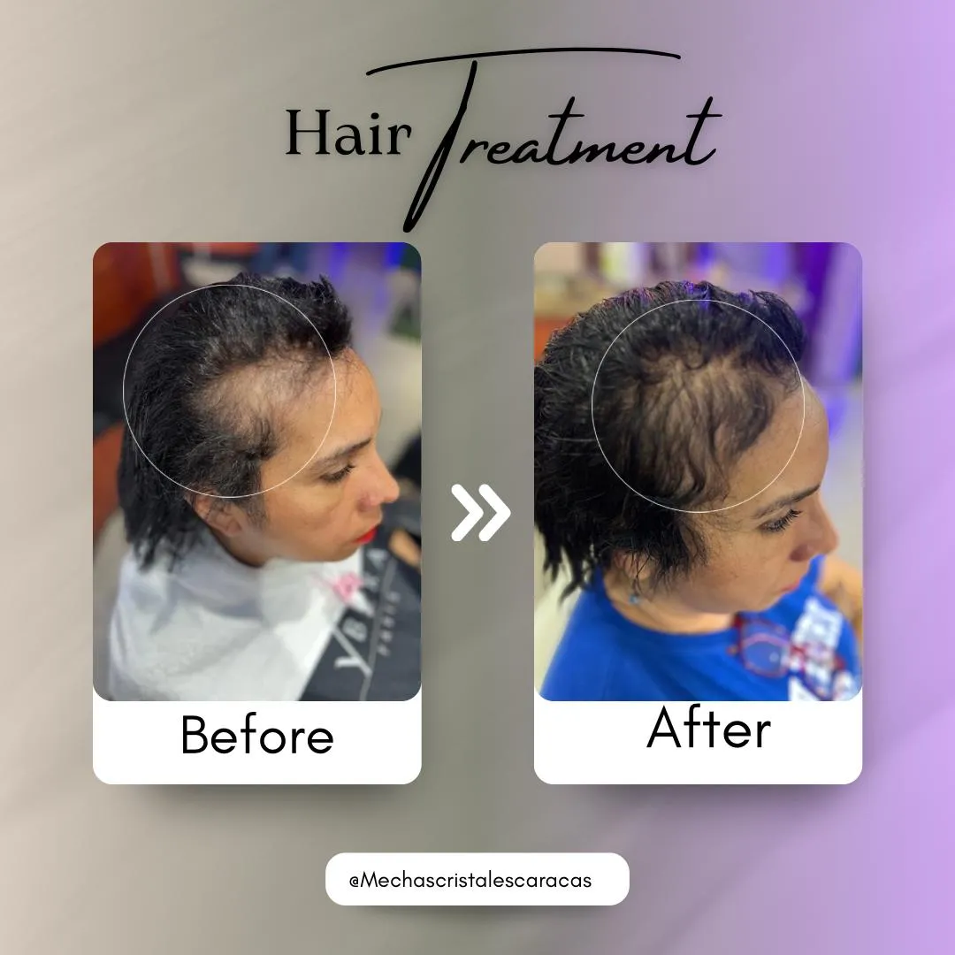 S.O.S (ANTI_CAIDA) - Imagen 4