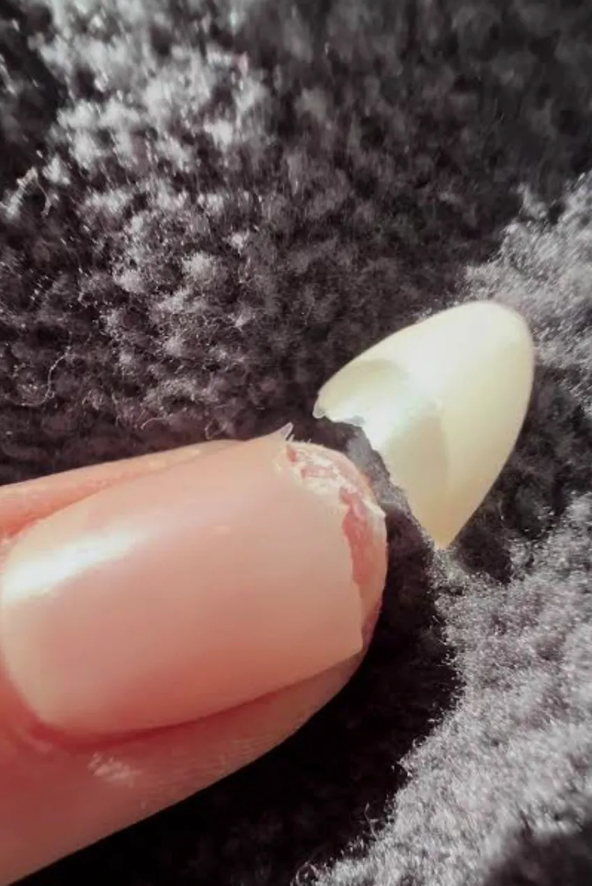 reconstrucción de uñas