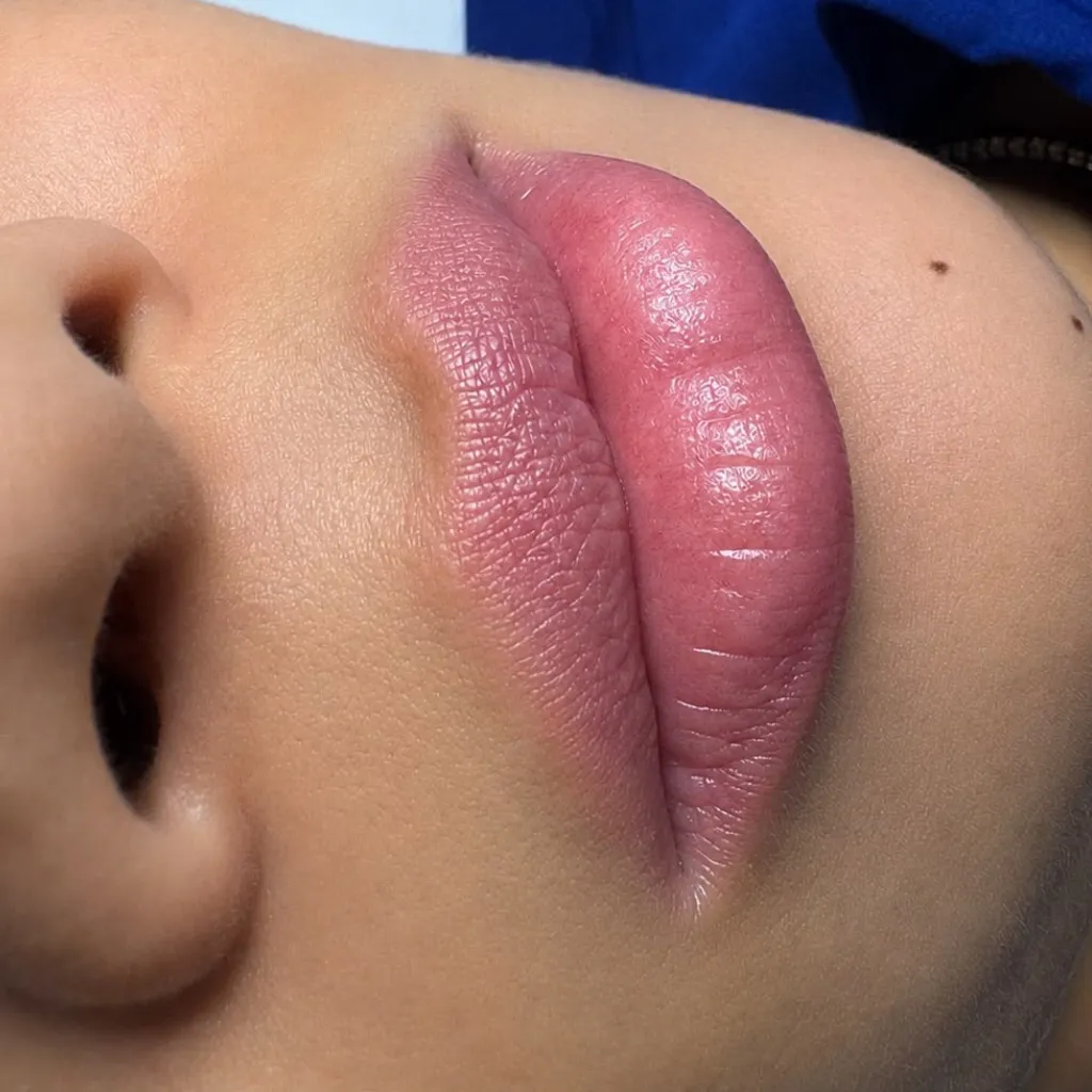 Baby lips